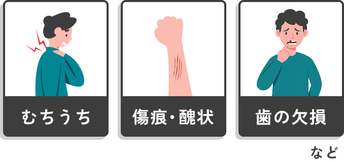 むちうち・傷痕・醜状・歯の欠損 など