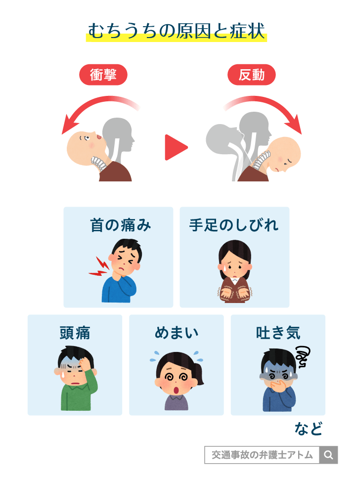 むちうちの原因と症状