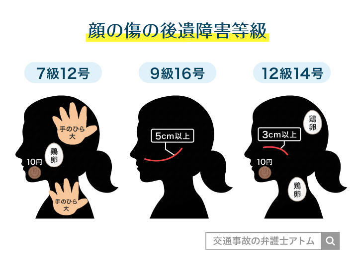 顔の傷の後遺障害等級