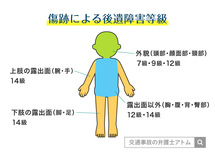 傷跡による後遺障害等級