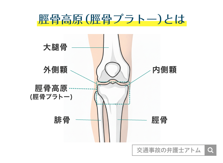 脛骨高原（脛骨プラトー）とは
