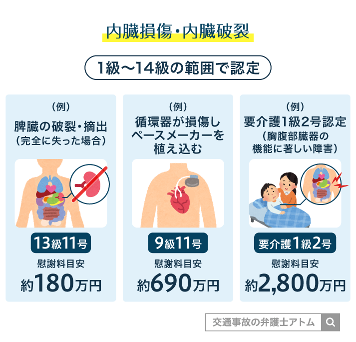 内臓損傷・内臓破裂