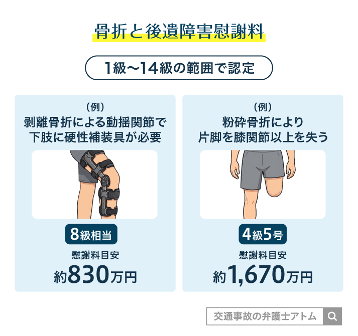 骨折と後遺障害慰謝料