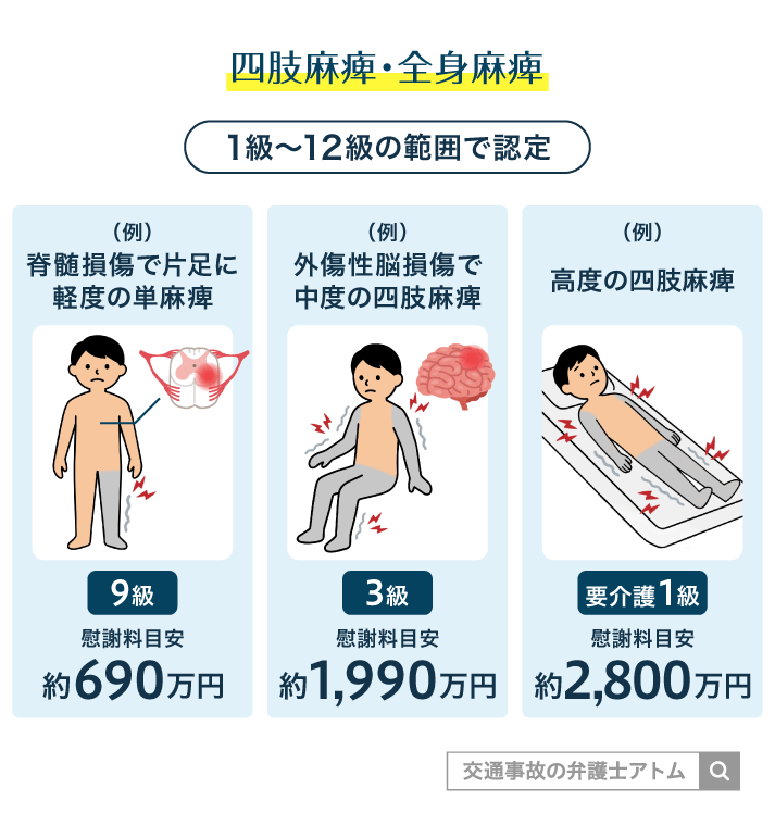 四肢麻痺・全身麻痺