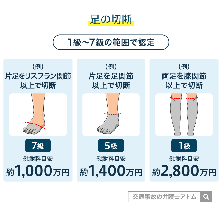 足の切断
