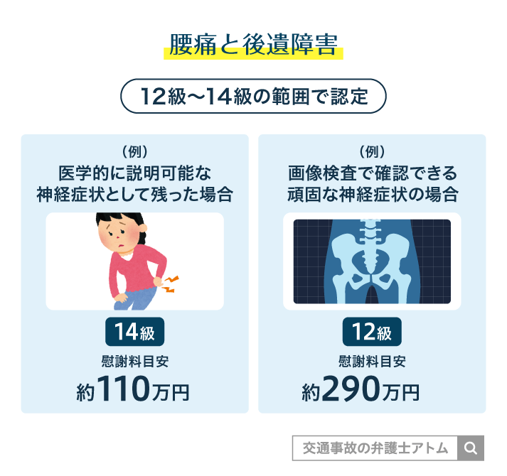 腰痛と後遺障害