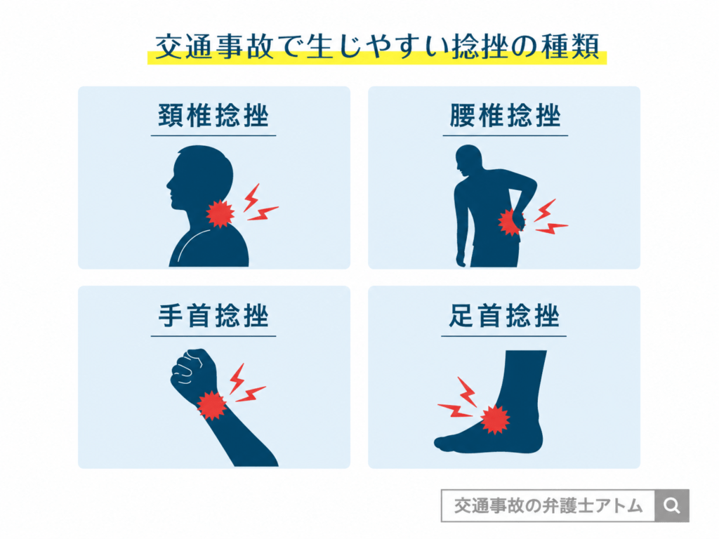 交通事故で生じやすい捻挫の種類