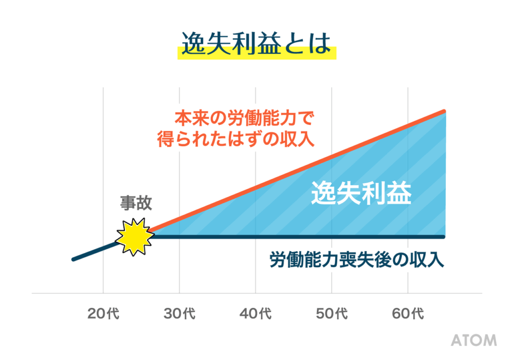 逸失利益とは